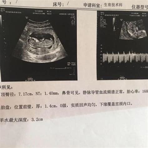 NT�����������к�Ů��(�Ա��໥ƥ�䣯Ȥζ����ģʽ�����Ի�ƥ��