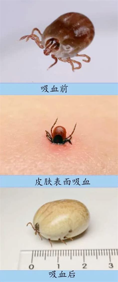 ��没��ʲô֢״(������没��ʲô֢״����)