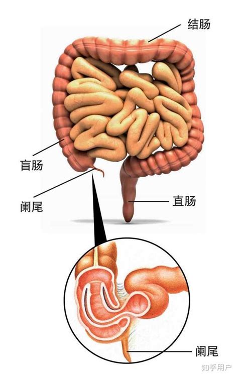 阑尾炎疼痛和阑尾在哪个位置(位置/疼痛/相关症状)