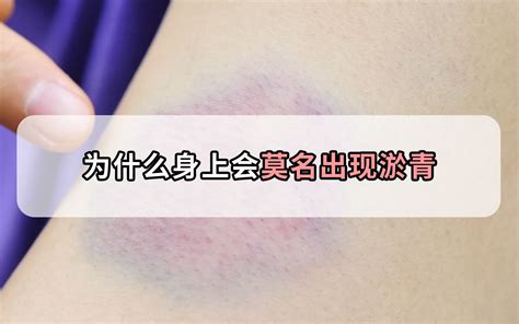 ������ȳ�������(ԭ�򣯴�����Ԥ��)