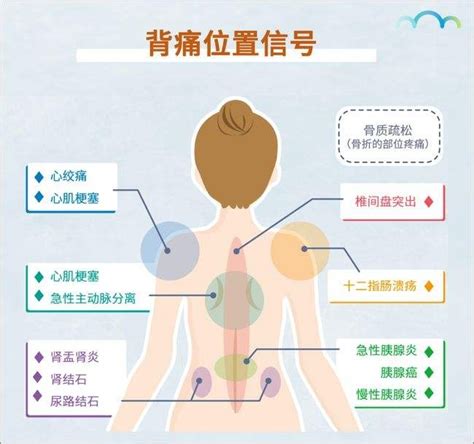 ��Ů����ʹλ��ͼ��⣬�����Һ���ʹ����ͼ(���ӱ���ԭ��)