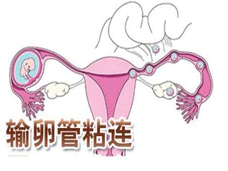 ���Ѷ����к�֢״(���Ѷ���ԭ��)