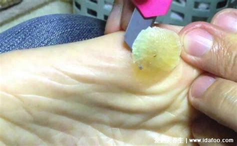 �����ڳ��������ͼ���ʵ����е�Բ׶״�Ľ���һ��Ҫ�ڸɾ�