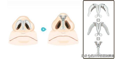 ������С�����ֳ�������ͼ��(������С�����ֳ�������)
