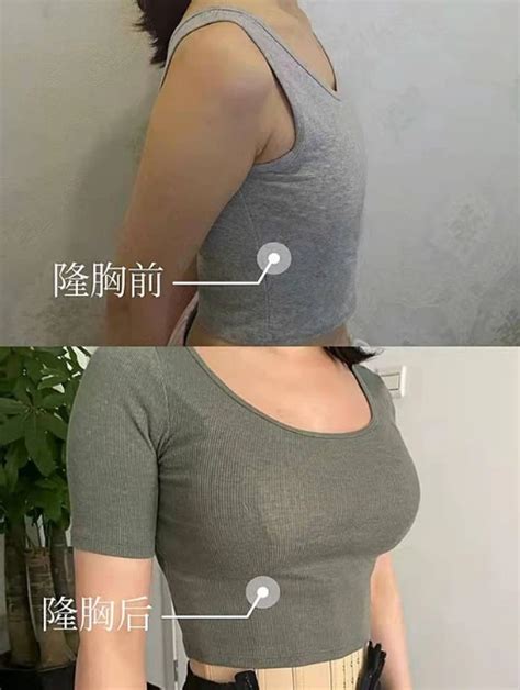 ��������������Ҫ����Ǯ