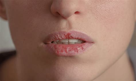 �촽������ô����