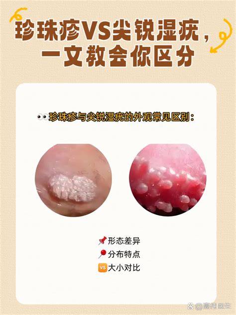 Ů�Լ�������������ͼ������ֱ�������